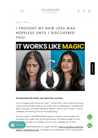 I Thought My Hair Loss Was Hopeless Until I Discovered This!