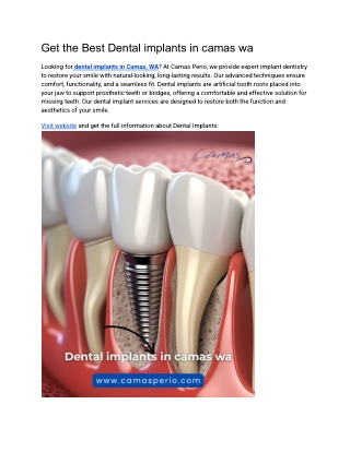 Get the Best Dental implants in camas wa