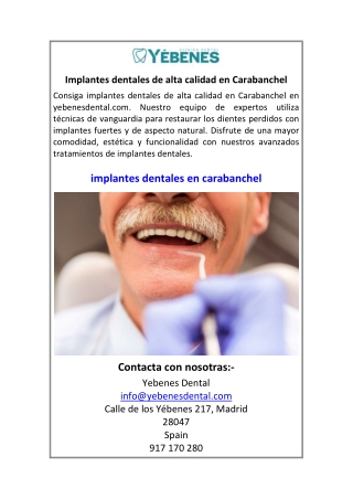 Implantes dentales de alta calidad en Carabanchel