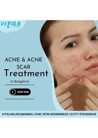 Best dermatologist in Bangalore - Vitals Skin and Hair Clinic