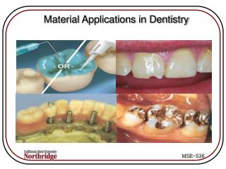 Material Applications in Dentistry