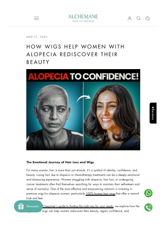 How Wigs Help Women with Alopecia Rediscover Their Beauty