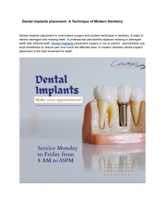Dental implants placement : A Technique of Modern Dentistry !