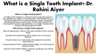 What is a Single Tooth Implant- Rohini Aiyer