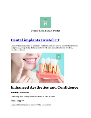 Dental implants Bristol CT