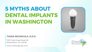5 Myths About Dental Implants in Washington