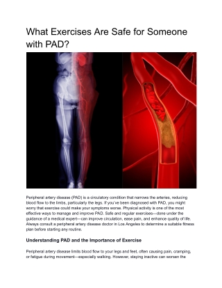What Exercises Are Safe for Someone with PAD?