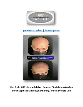 geheimratsecken | lionscalp.com
