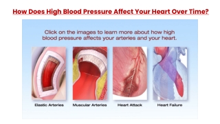 How Does High Blood Pressure Affect Your Heart Over Time