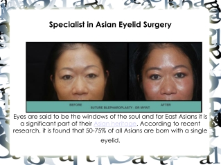 Asian blepharoplasty