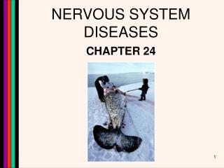 NERVOUS SYSTEM DISEASES
