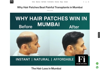 Why Hair Patches Beat Painful Transplants in Mumbai
