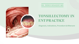 Tonsillectomy in ENT Practice