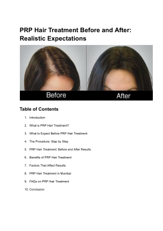 PRP Hair Treatment Before and After_ Realistic Expectations