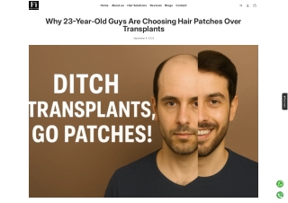 Why 23-Year-Old Guys Are Choosing Hair Patches Over Transplants