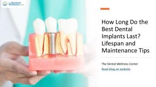 How Long Do the Best Dental Implants Last Lifespan and Maintenance Tips_