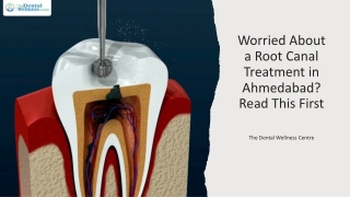 Worried About a Root Canal Treatment in Ahmedabad Read This First_