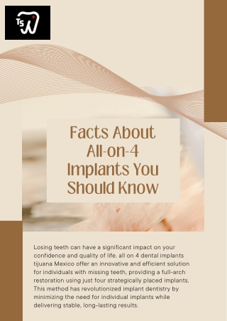 Facts About All-on-4 Implants You Should Know