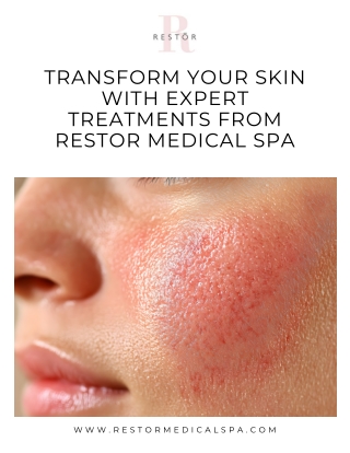 Transform Your Skin with Expert Treatments from Restor Medical Spa