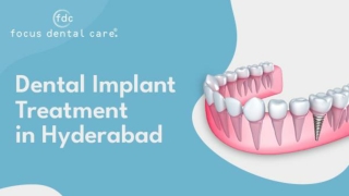 Dental Implant Treatment in Hyderabad | Focus Dental Care