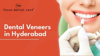 Dental Veneers in Hyderabad Focus Dental Care