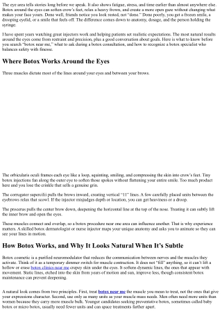 Botox Around the Eyes: Safety Tips and Natural Results