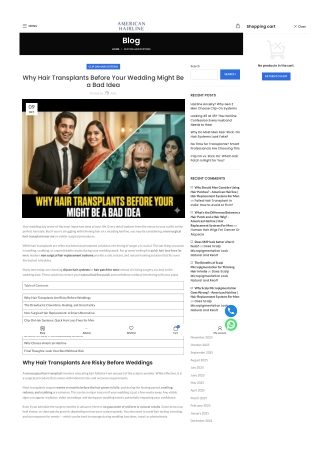 Why Hair Transplants Before Your Wedding Might Be a Bad Idea