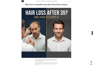“Understanding the causes of hair loss after age 35.”