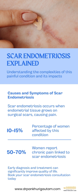 Scar Endometriosis Treatment by Dr. Pankhuri Gautam