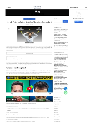 Is Hair Patch A Better Solution Then Hair Transplant