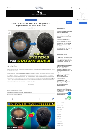 Get a Natural Look With Non-Surgical Hair Replacement for the Crown Area