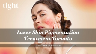 Effective Skin Pigmentation Treatment Toronto