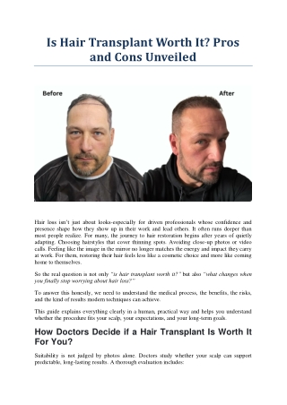 Is Hair Transplant Worth It Pros and Cons Unveiled | UniquEra Clinic