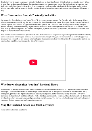 Overactive Frontalis: Smart Dosing to Avoid Brow Drop