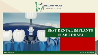 BEST DENTAL  IMPLANTS IN ABU DHABI