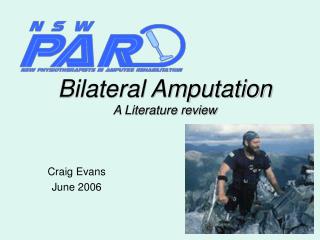 Bilateral Amputation A Literature review