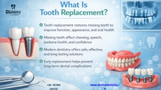 Tooth Replacement | Dental Implants | Omleshs Dentcity
