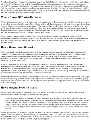 The Botox Brow Lift vs Surgical Brow Lift: Pros and Cons