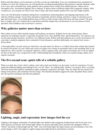 Botox Trusted Results: How to Vet Before-and-After Galleries