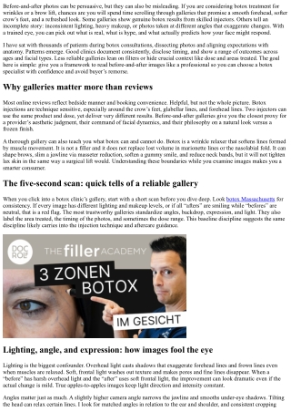 Botox Trusted Results: How to Vet Before-and-After Galleries