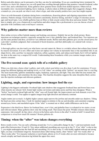 Botox Trusted Results: How to Vet Before-and-After Galleries