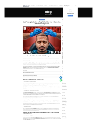 Hair Transplants Are a Trap What No One Tells Indian Men About Regrowth