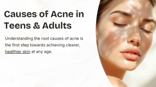 Causes-of-Acne-in-Teens-and-Adults.pptx