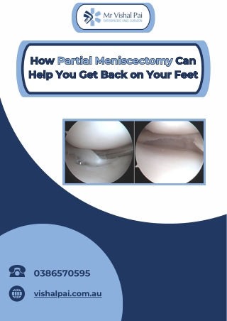 How Partial Meniscectomy Can Help You Get Back on Your Feet
