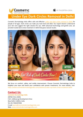 Under Eye Dark Circles Removal in Delhi