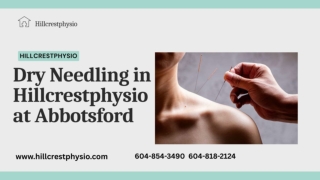 Dry needling  in Hillcrestphysio at abbotsford