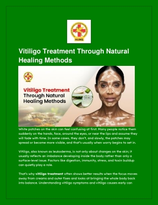 Vitiligo Treatment Through Natural Healing Methods