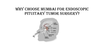 Why Choose Mumbai for Endoscopic Pituitary Tumor Surgery