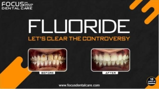 How Fluoride Helps in Cavity Prevention | Focus Dental