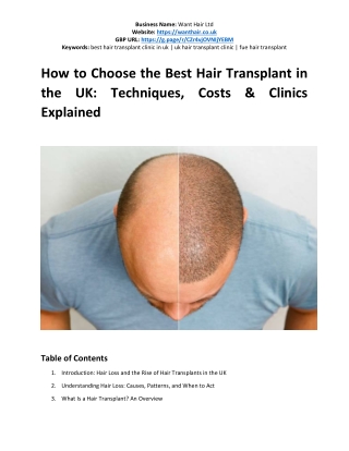 How to Choose the Best Hair Transplant in the UK: Techniques, Costs & Clinics